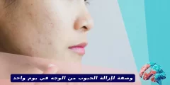 وصفة لإزالة الحبوب من الوجه في يوم واحد