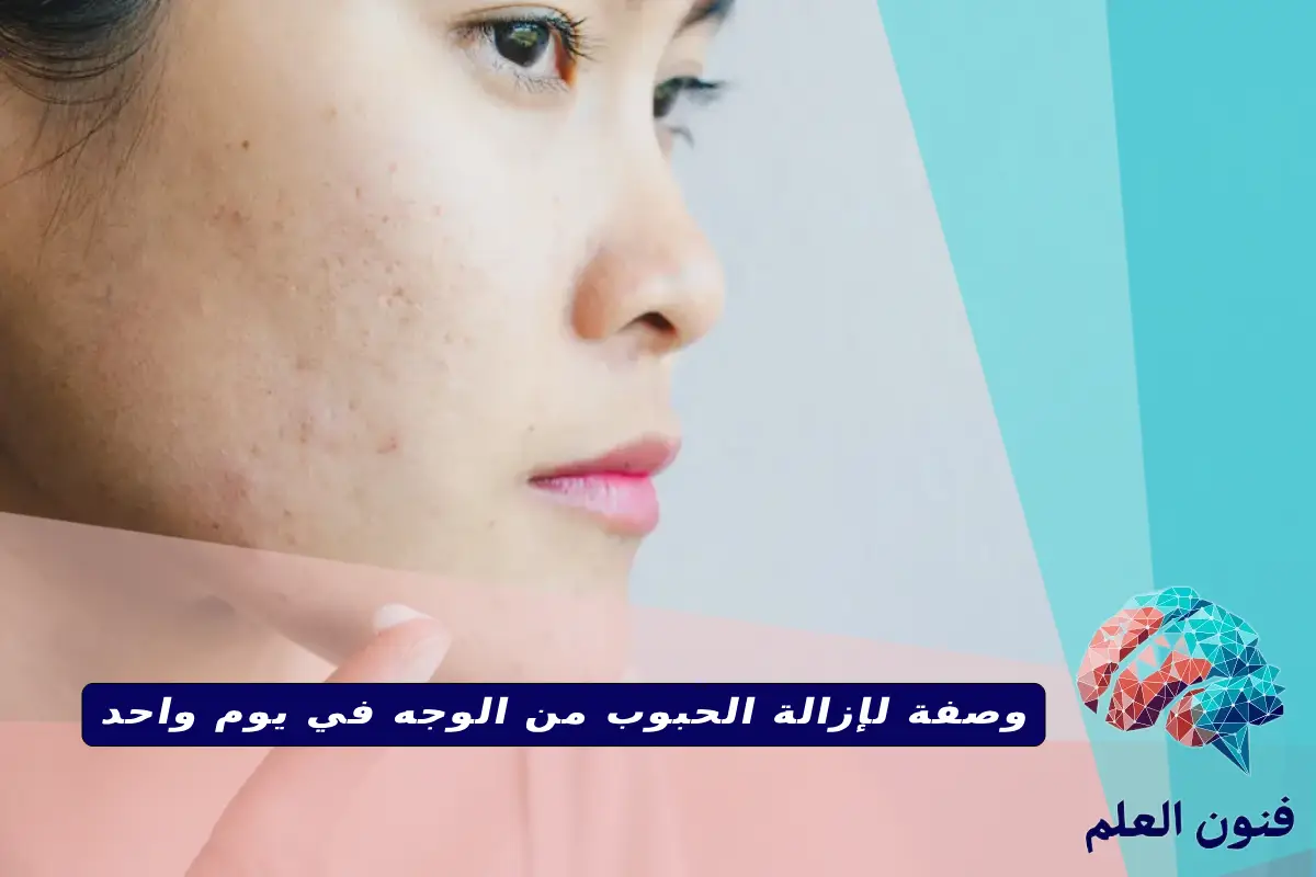 وصفة لإزالة الحبوب من الوجه في يوم واحد